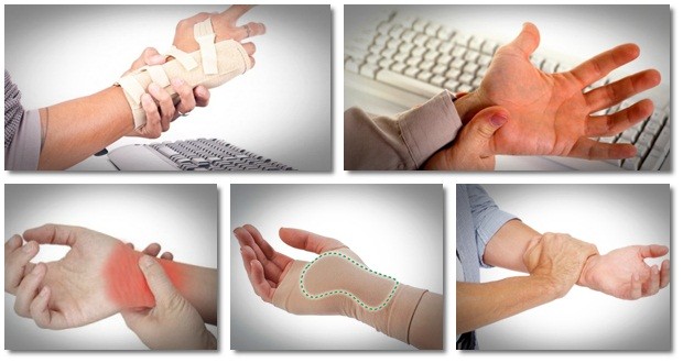 carpal tunnel home treatment review carpal tunnel secrets unleashed system
