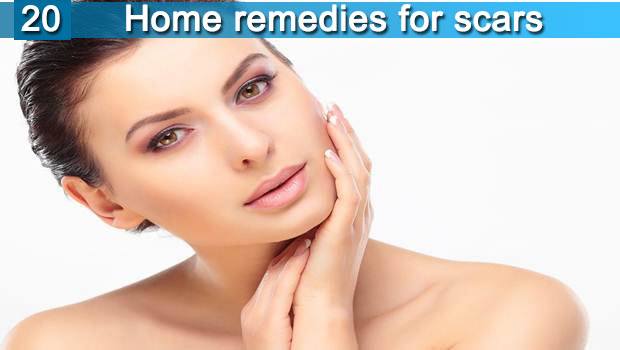 20 home remedies for scars, dark spots &amp; blemishes on face