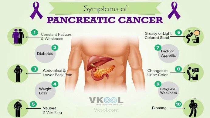 10 Early Symptoms Of Pancreatic Cancer In Humans 5465