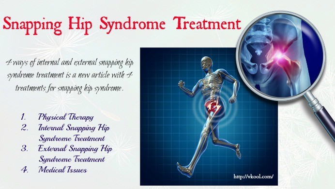 4 Ways Of Internal And External Snapping Hip Syndrome Treatment