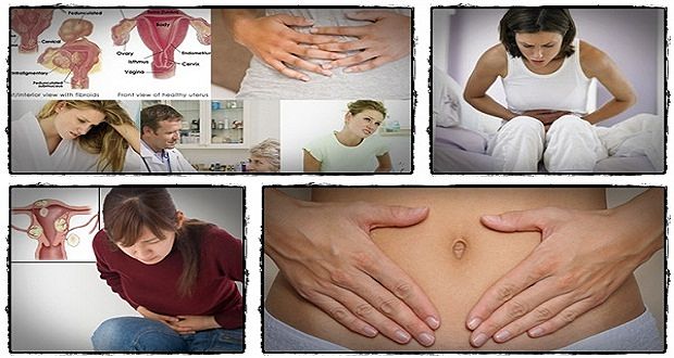 Fibroids miracle treament