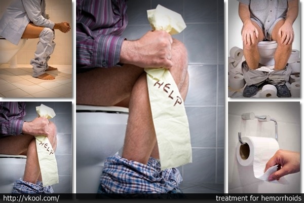 Treatment for hemorrhoids