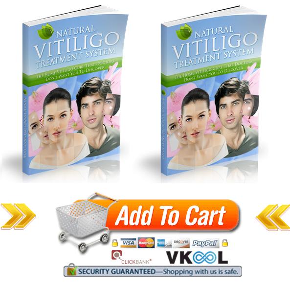 Natural vitiligo treatment system order