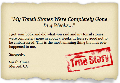 banish tonsil stones 