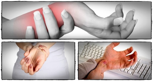 Carpal tunnel syndrome