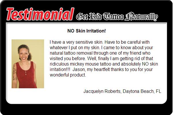 Get rid tattoo naturally reviews