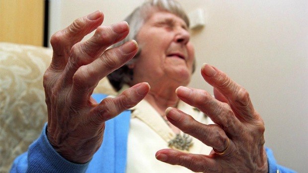 arthritis relief miracle