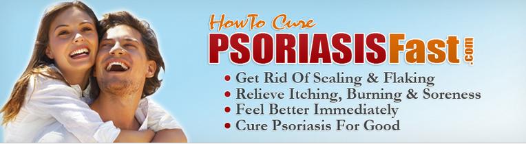 how to control psoriasis fast psoriasis cure