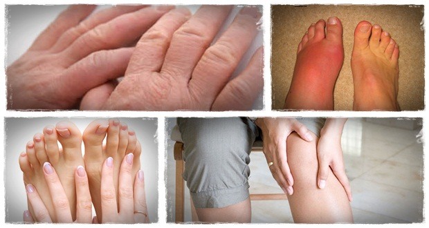 how to get rid of gout the gout remedy report 7