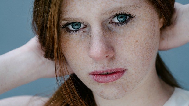 dealing with freckle with healthy foods download