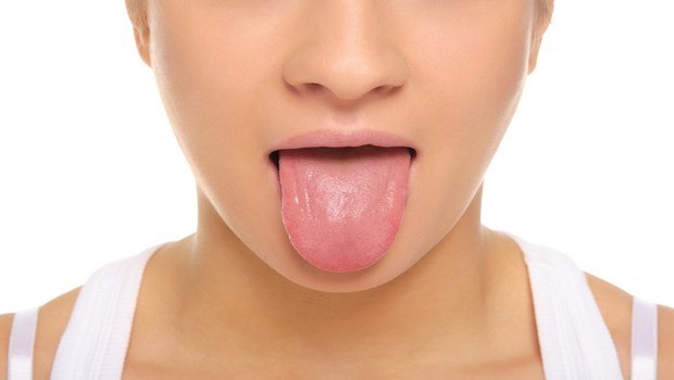 home remedies for oral thrush-diet for oral thrush