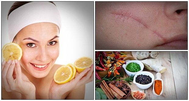 home remedies for scars on lips