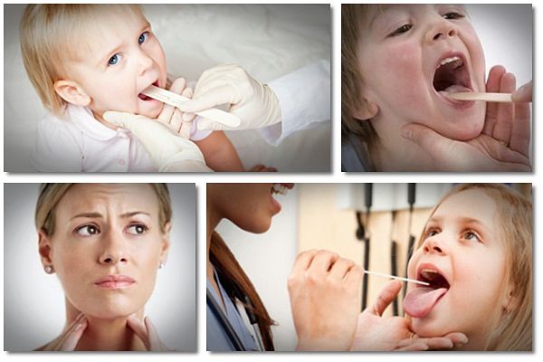 home remedies for tonsillitis in babies