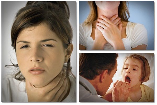 natural remedies for sore throat swollen tonsils