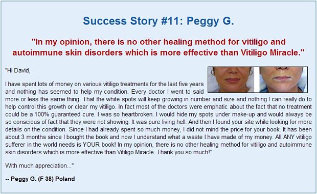 Vitiligo miracle comment