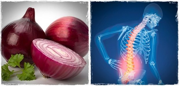 ways to prevent osteoporosis review onions