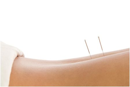 acupuncture and herbs review