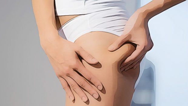 what cellulite really