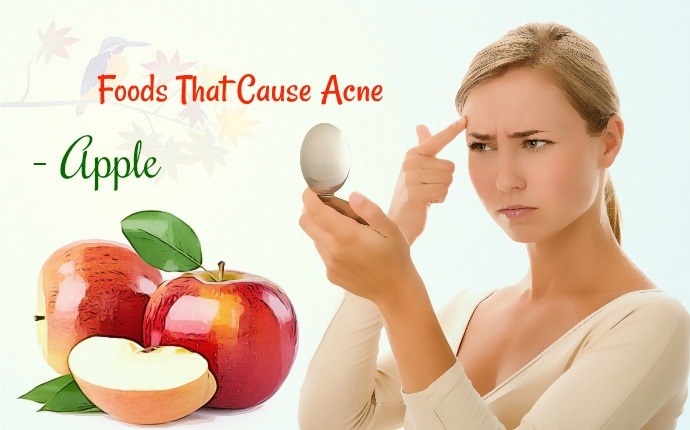 foods that cause acne - apple