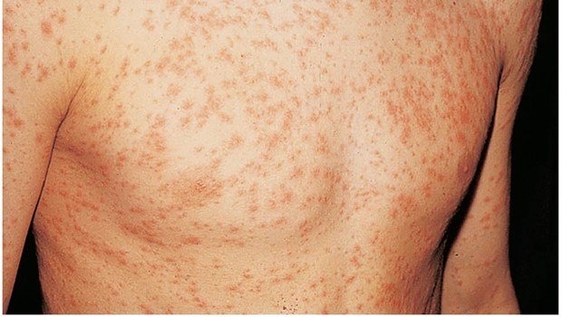 common skin disorders