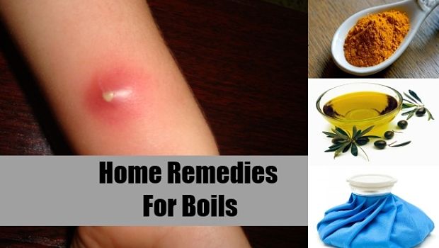 home remedies for boils