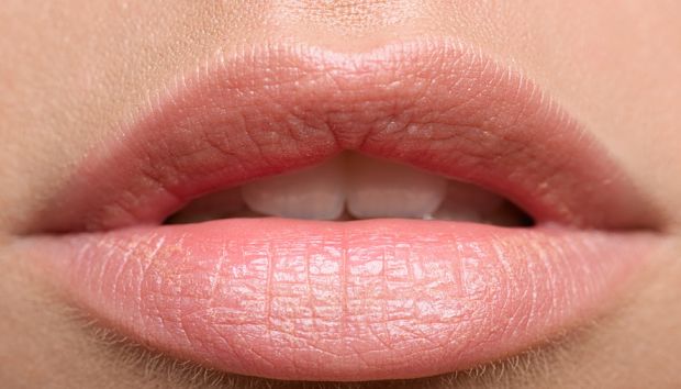 how to get rid of dry lips