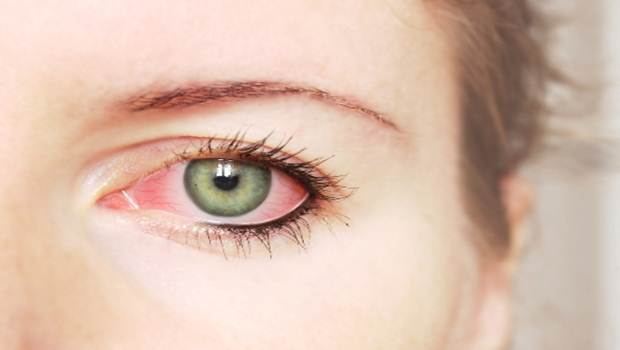how to prevent pink eye