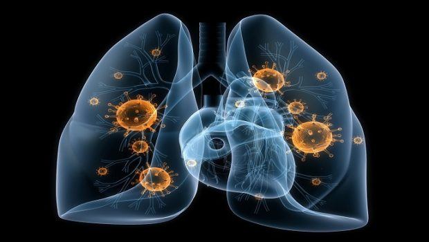 home remedies for pneumonia