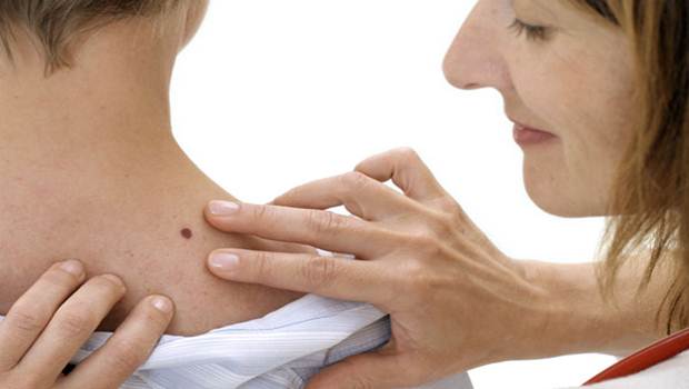 signs of skin cancer