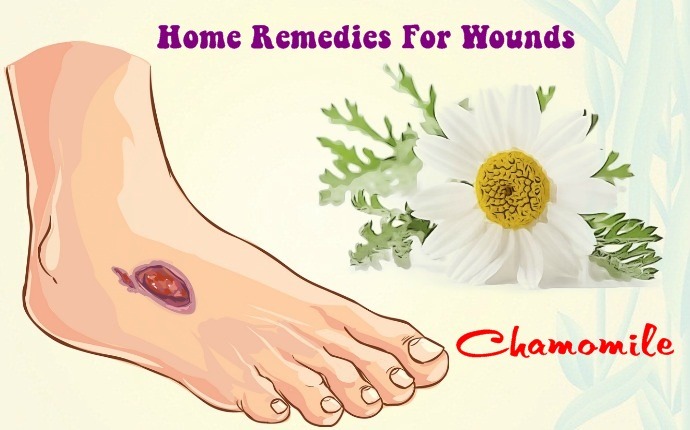 home remedies for wounds - chamomile
