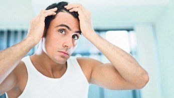 home remedies for alopecia
