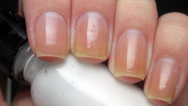 10 Tips On How To Get Rid Of Yellow Nails From Nail Polish Fast