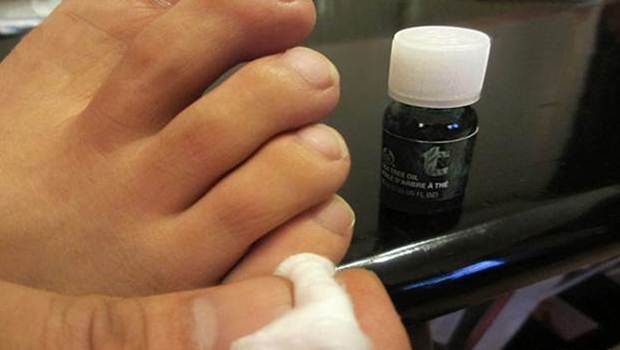 how to get rid of blood blisters