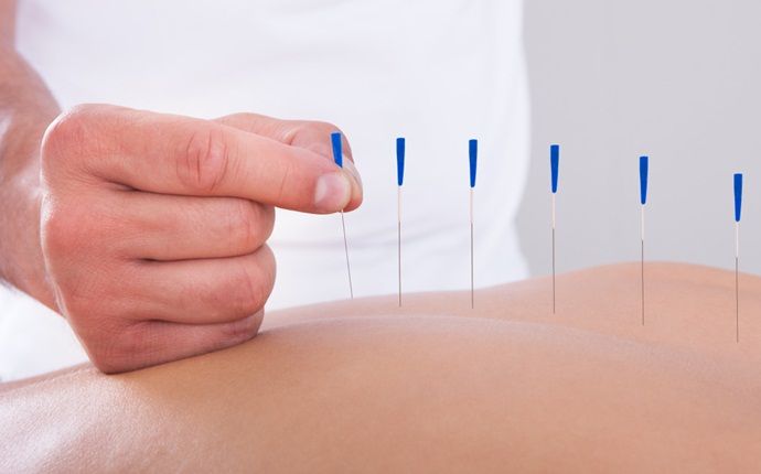 home remedies for tendonitis - acupuncture