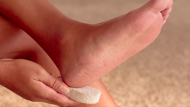 benefits of strawberry-treat cracked heels