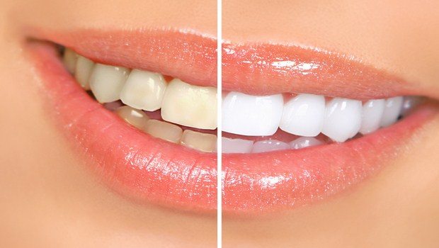 benefits of strawberry-whiten teeth