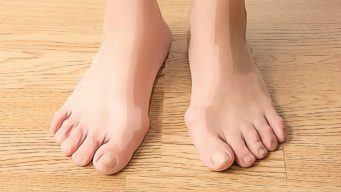 home remedies for bunions pain