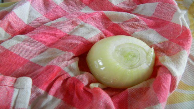 home remedies for frostbite-onion poultice