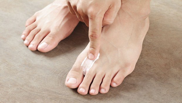 how to stop itchy feet-home remedy to treat your itchy feet