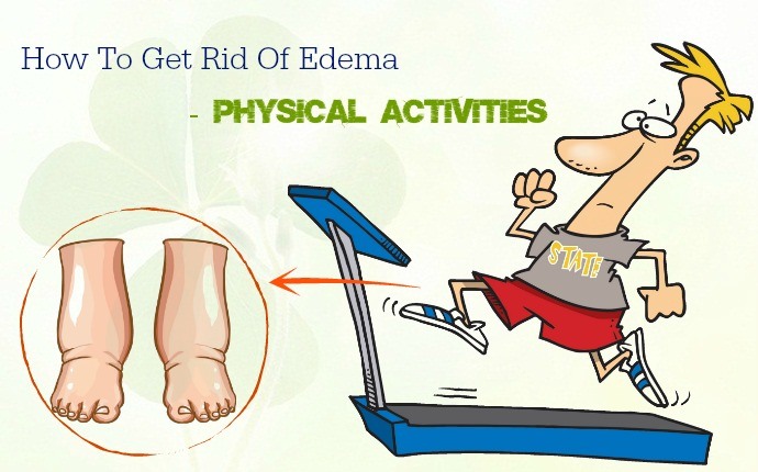how to get rid of edema - physical activities