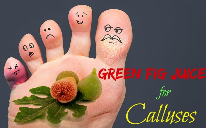 home remedies for calluses - green fig juice