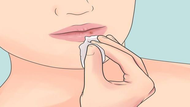 how to prevent cold sores-clean the cold sores