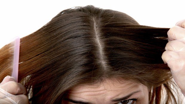 how to prevent head lice-avoid sharing personal items
