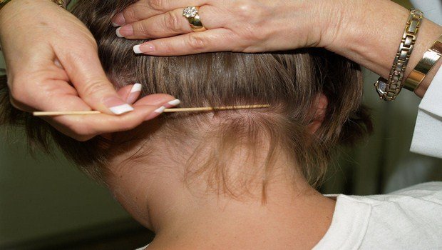 how to prevent head lice-be vigilant