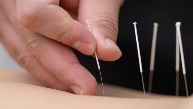 how to treat cystitis-try regular acupuncture treatments