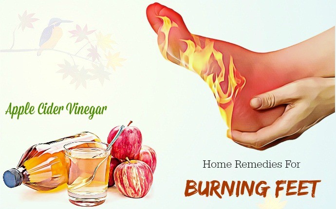 home remedies for burning feet - apple cider vinegar