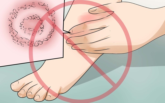 how to treat folliculitis - avoid touching the affected area