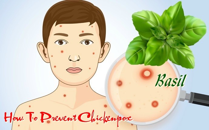 how to prevent chickenpox - basil