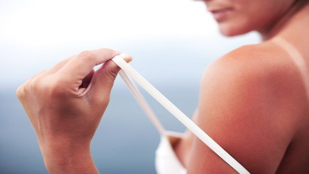 benefits of coconut milk-treatment of sunburns