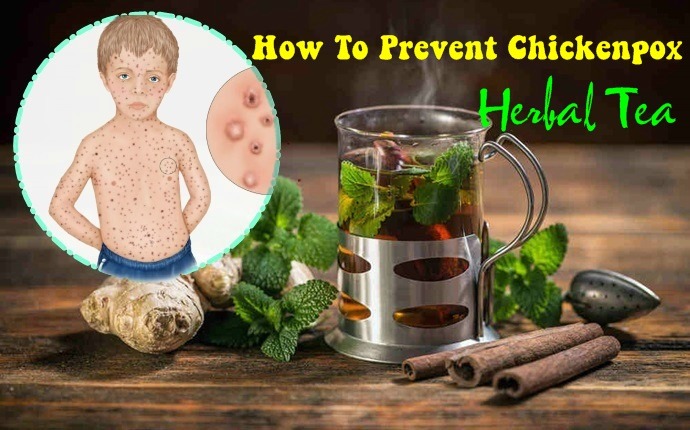 how to prevent chickenpox - herbal tea